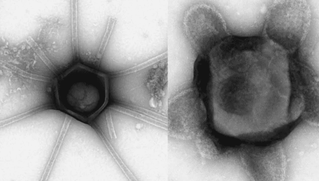 Naiavírus: Cientistas Acham Vírus Gigante no Pantanal