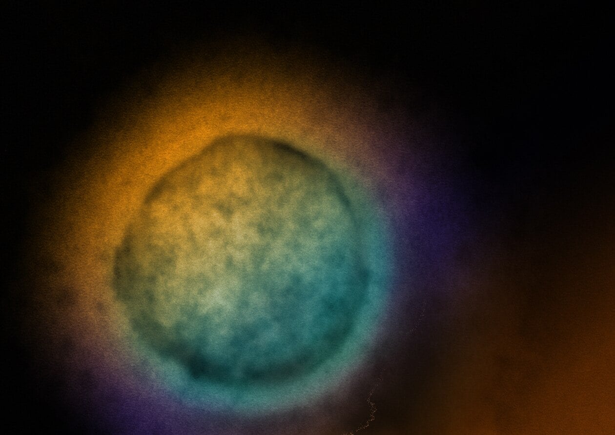 Ministério da Saúde Descarta Risco do Vírus Nipah ao Brasil - Imagem do artigo original